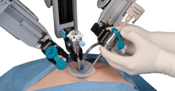Chirurgia robotică, vârf de performanţă şi în România