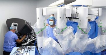 Chirurgia robotică abdominală