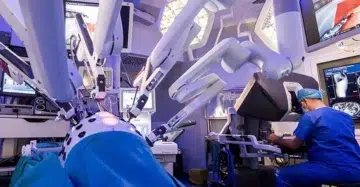 tumora toracica gigant, operata cu ajutorul robotului da Vinci