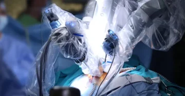 bratele unui robot medical in timpul unei interventii