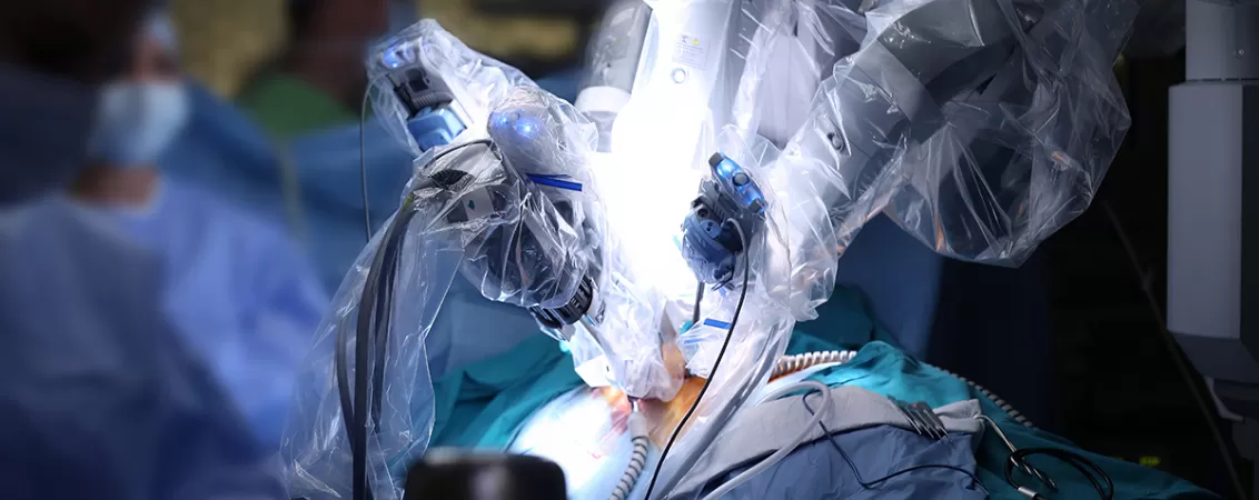 bratele unui robot medical in timpul unei interventii
